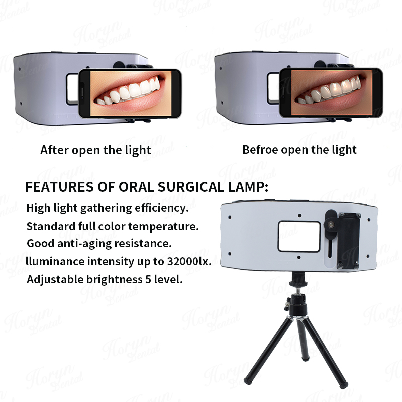 Dental Flash Light Photography - огляд і ціна Photography Equipment